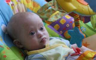 Символ синдрома дауна symbol down syndrome