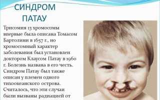 13 пара хромосом синдром патау