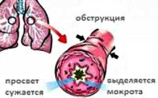Код мкб обструктивный бронхит острый