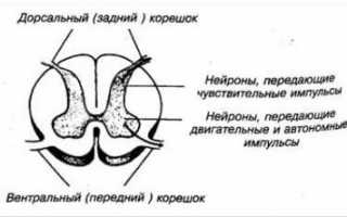Корешковый синдром на фоне поясничного остеохондроза