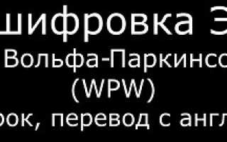 Экг при синдроме wpw тип а