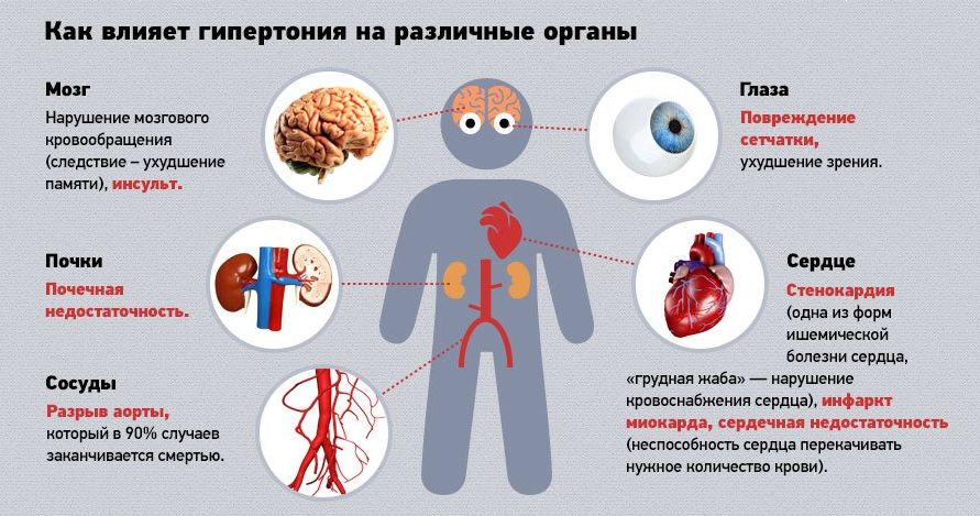 Синдром па по мкб 10