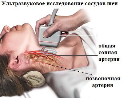 Синдром па по мкб 10