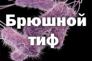 Симптомы брюшного тифа