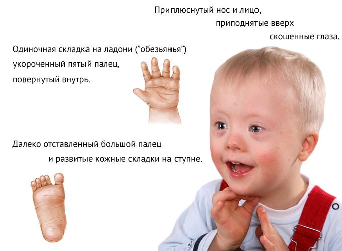 Симптомы и признаки болезни