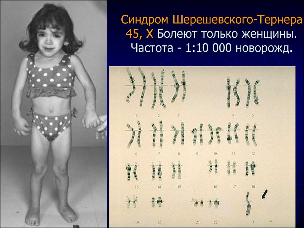 Наследственное заболевание