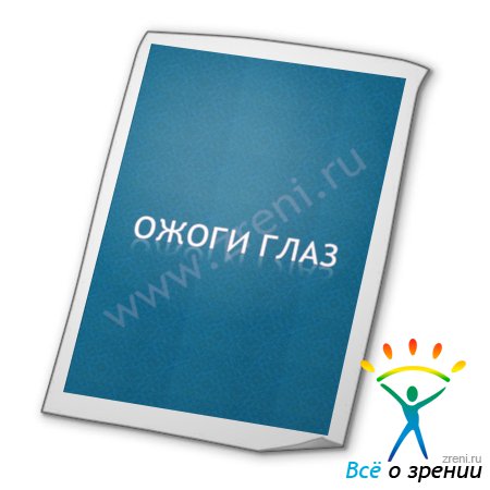 Ожоги глаз