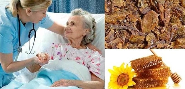 Пролежни народные средства с прополисом