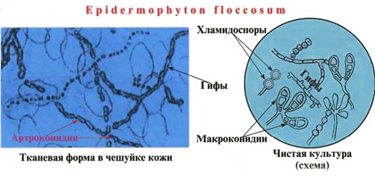 5468864846
