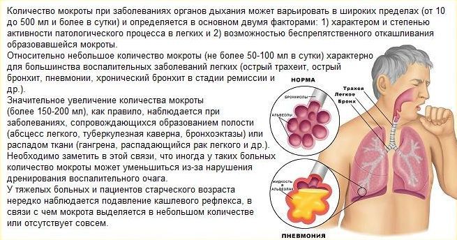Остаточный кашлевой синдром