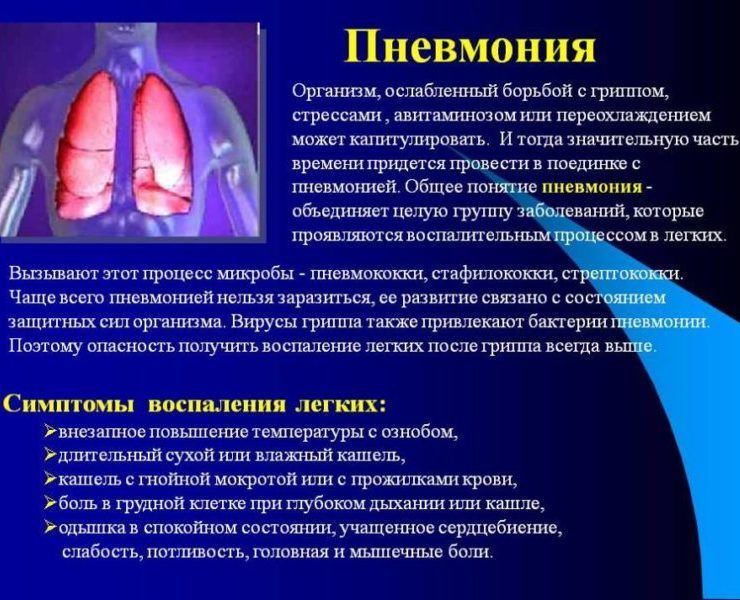 Пневмония