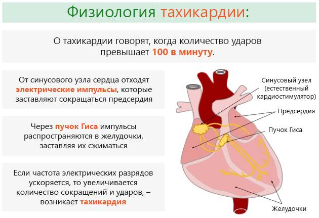 Пневмония может сопровождаться тахикардией