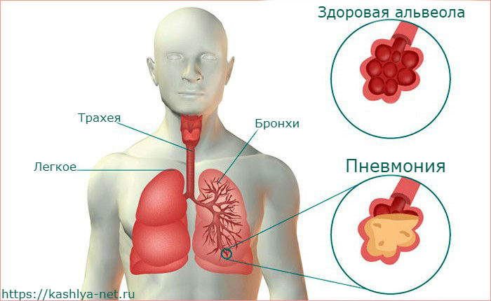 схема лёгких