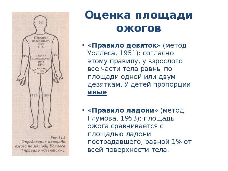 Оценка площади ожогов
«Правило девяток» (метод Уоллеса, 1951): согласно этому правилу, у взрослого все части тела равны по площади одной или двум девяткам. У детей пропорции иные.
«Правило ладони» (метод Глумова, 1953): площадь ожога сравнивается с площадью ладони пострадавшего, равной 1% от всей поверхности тела.
Ожоги глаз презентация скачать бесплатно
