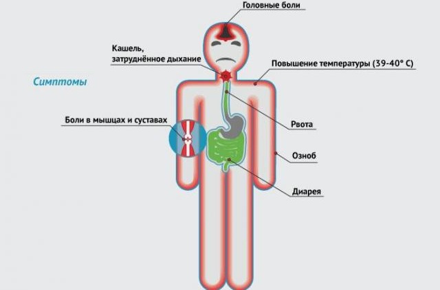 Симптомы болезни